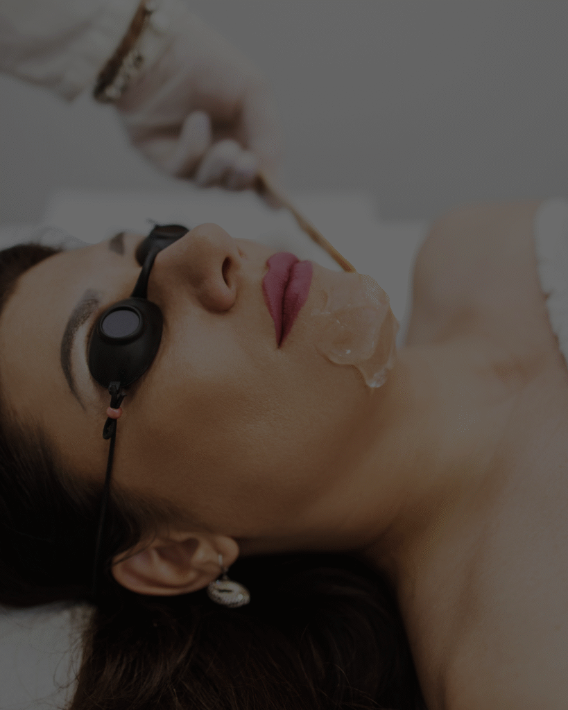 Femme allongée avec des lunettes de protection noires, recevant un soin esthétique sur le menton. Un praticien applique un gel transparent avec une spatule en bois.